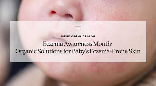 The Best Organic Solutions for Your Baby's Eczema-Prone Skin